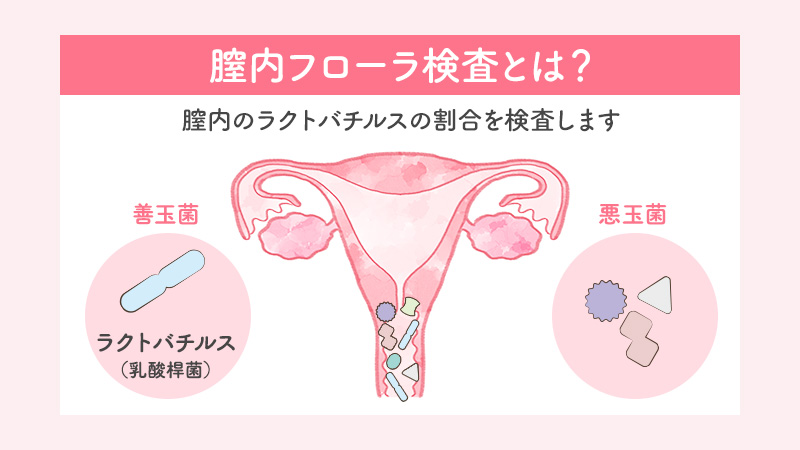 腟内フローラ検査のイメージ画像